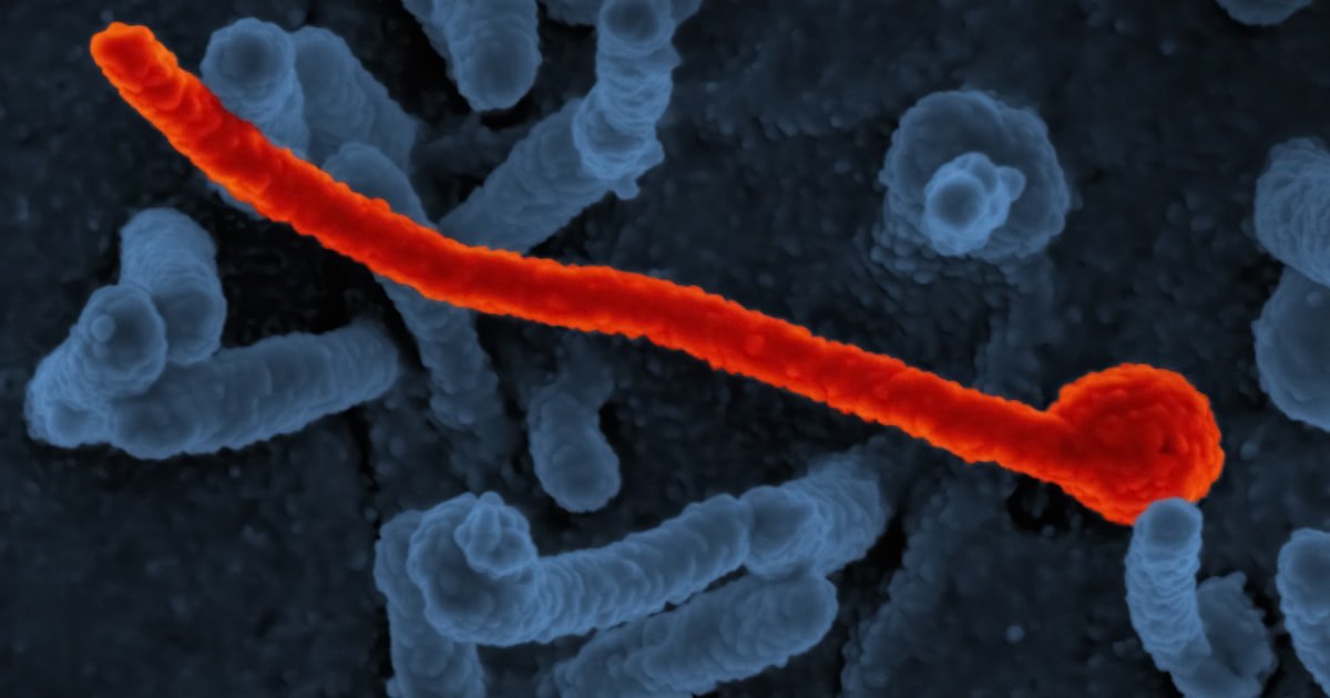 A summer parasite outbreak is testing U.S. food-safety surveillance as cases climb across 31 states