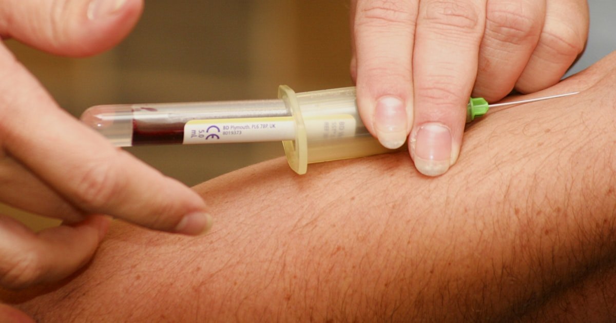 The Race to Make a Blood Test Catch Colon Cancer Earlier Just Got More Serious